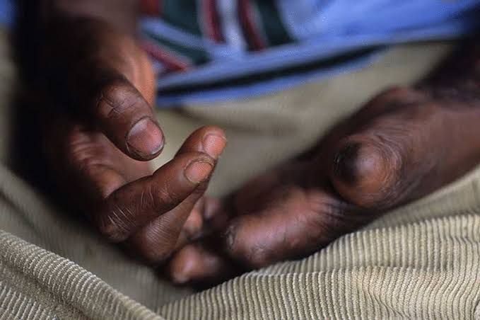 Neglected Tropical Disease Program
